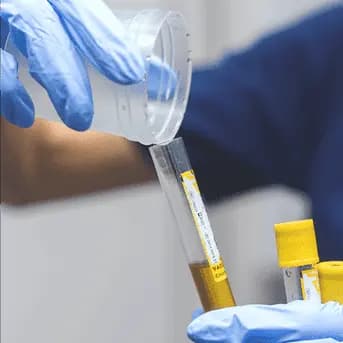 STD Test - 14 Panel